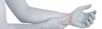 Síndrome del túnel carpiano y su abordaje en FisioClinics Logroño