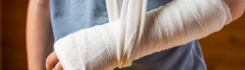 Abordaje desde la fisioterapia para las fracturas óseas - FisioClinics Palma