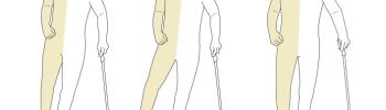 Hemiplejia tras ictus: claves para la recuperación funcional desde la fisioterapia