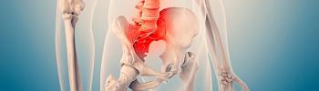 ¿En qué consiste la Sacroileítis? - Tratamiento en FisioClinics Palma ¿En qué consiste la Sacroileítis? - Tratamiento en FisioClinics Palma