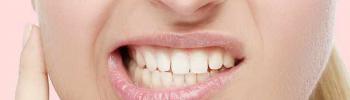 Bruxismo, qué es, causas y su tratamiento mediante fisioterapia 