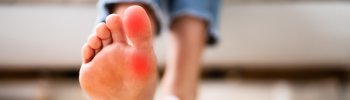 Cómo mejorar la alineación del pie con ejercicios de fisioterapia.