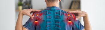 Calcificaciones en los hombros: causas y tratamientos con fisioterapia