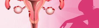 Abordaje integral en pacientes con endometriosis Abordaje integral en pacientes con endometriosis