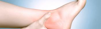 Tratamiento de osteopatía en esguinces de tobillo
