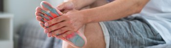 Fascitis Plantar: Causas, Síntomas y Tratamientos