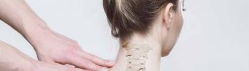 Tratamiento mediante la Fisioterapia para la Hernia Discal Cervical en FisioClinics Bilbao Tratamiento mediante la Fisioterapia para la Hernia Discal Cervical en FisioClinics Bilbao