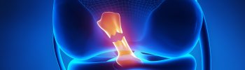 Protocolo de fisioterapia para la rehabilitación de una rotura de ligamentos cruzados