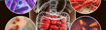 Microbiota en Coloproctología Microbiota en Coloproctología