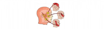 neuralgia trigemino