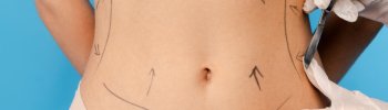 Recuperación tras liposucción: qué hacer para disminuir edema y fibrosis