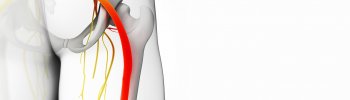 Fisioterapia para el síndrome del piramidal en FisioClinics Palma
