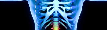 Estimulación eléctrica transcutánea (TENS) el tratamiento de la hernia discal lumbar