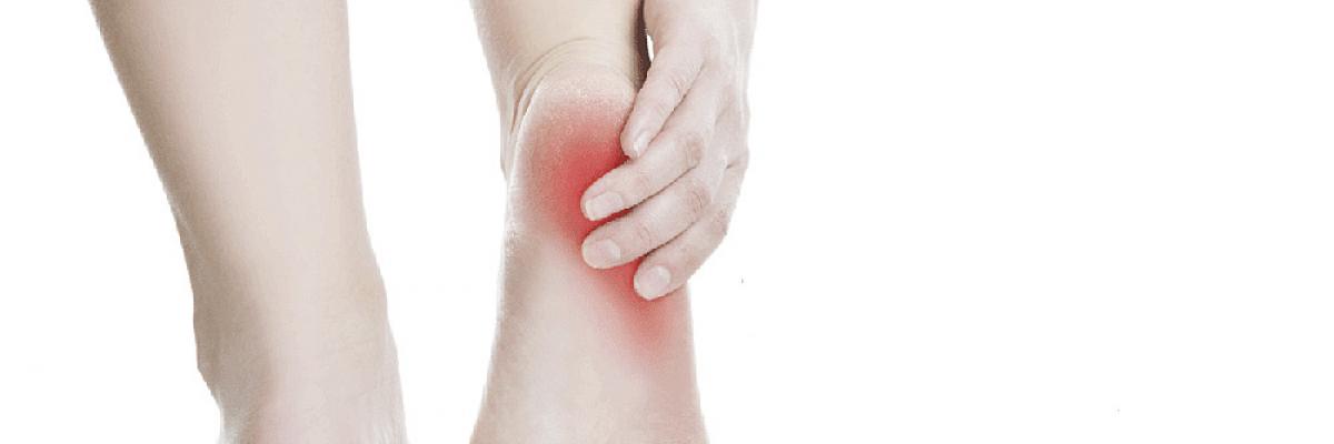 Tendinitis del tendón de Aquiles