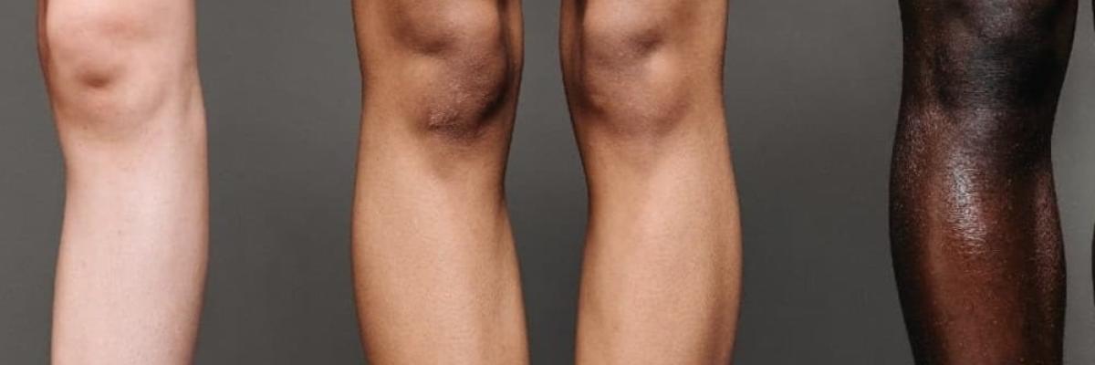 Tendinitis de la pata de ganso: causas, síntomas y tratamiento fisioterapéutico