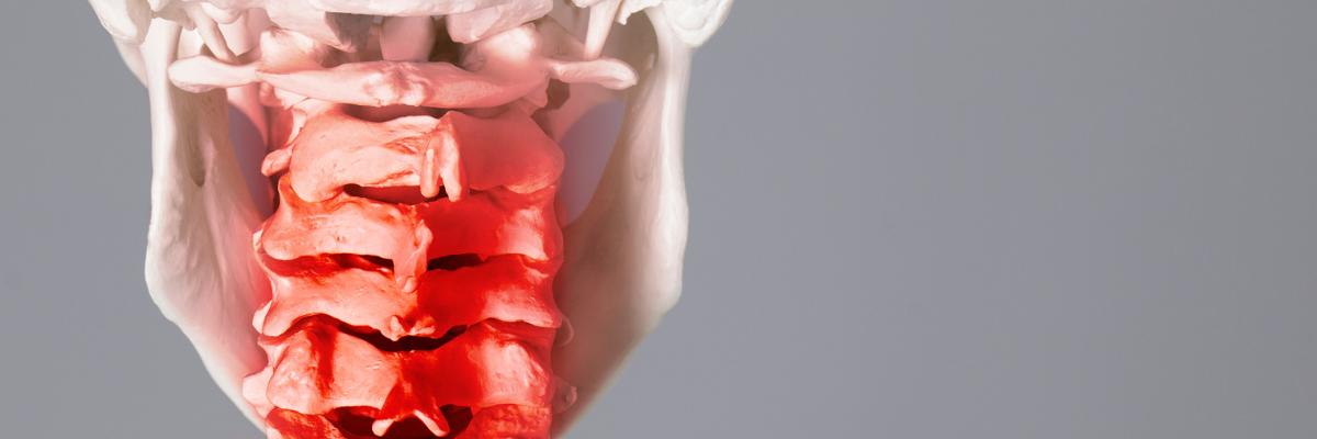 Técnicas de movilización articular para aliviar la rigidez en la artrosis cervical