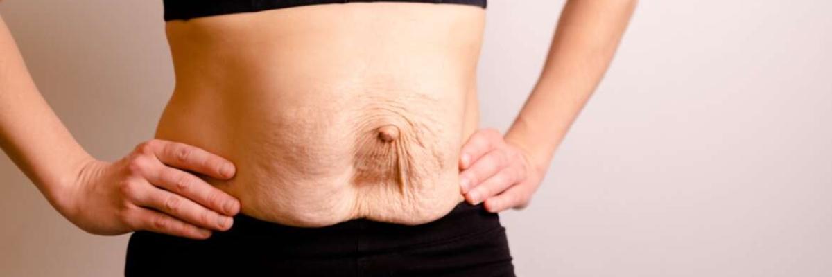Fisioterapia y pilates para la diástasis abdominal postparto