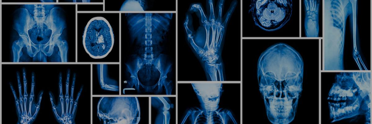Deja el carrito de las pruebas diagnósticas