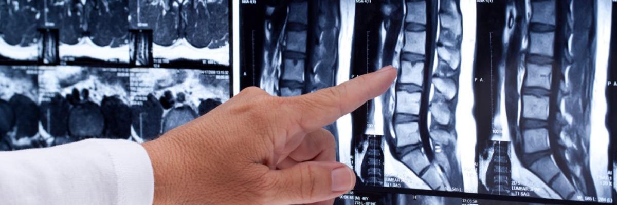 Cuidado con las resonancias magnéticas