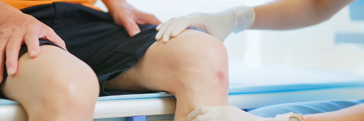 Ejercicios de fisioterapia para aliviar la artrosis de rodilla