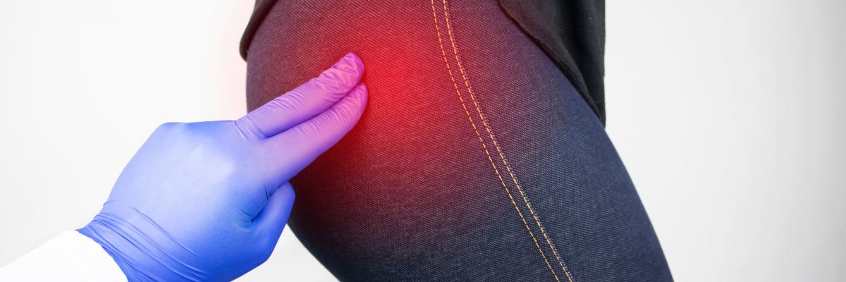 Terapia manual para el síndrome del piramidal: aliviando el dolor de glúteo